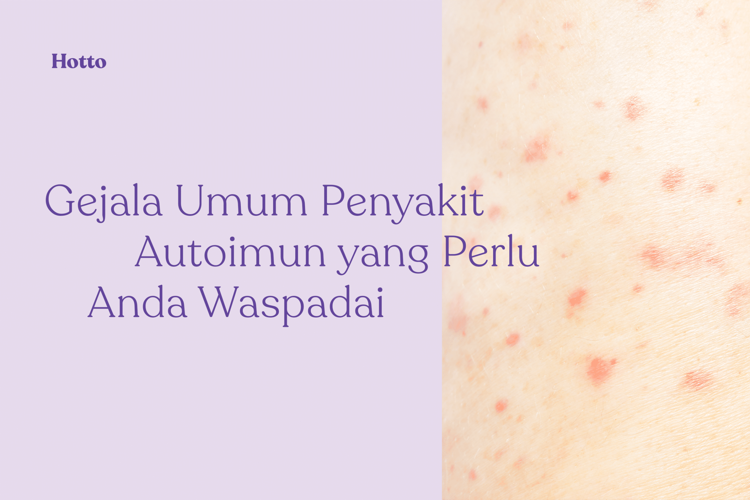 Jenis Penyakit Autoimun Yang Perlu Anda Waspadai