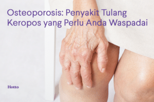 Osteoporosis Penyakit Tulang Keropos yang Perlu Diwaspadai