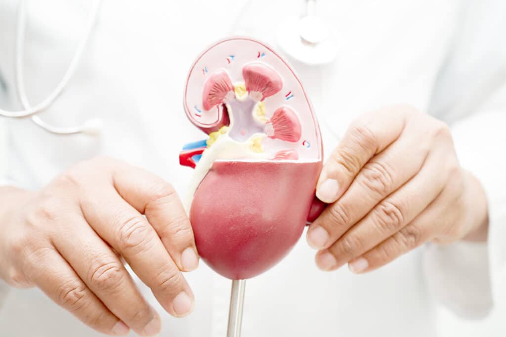 Penyebab IgA Nephropathy