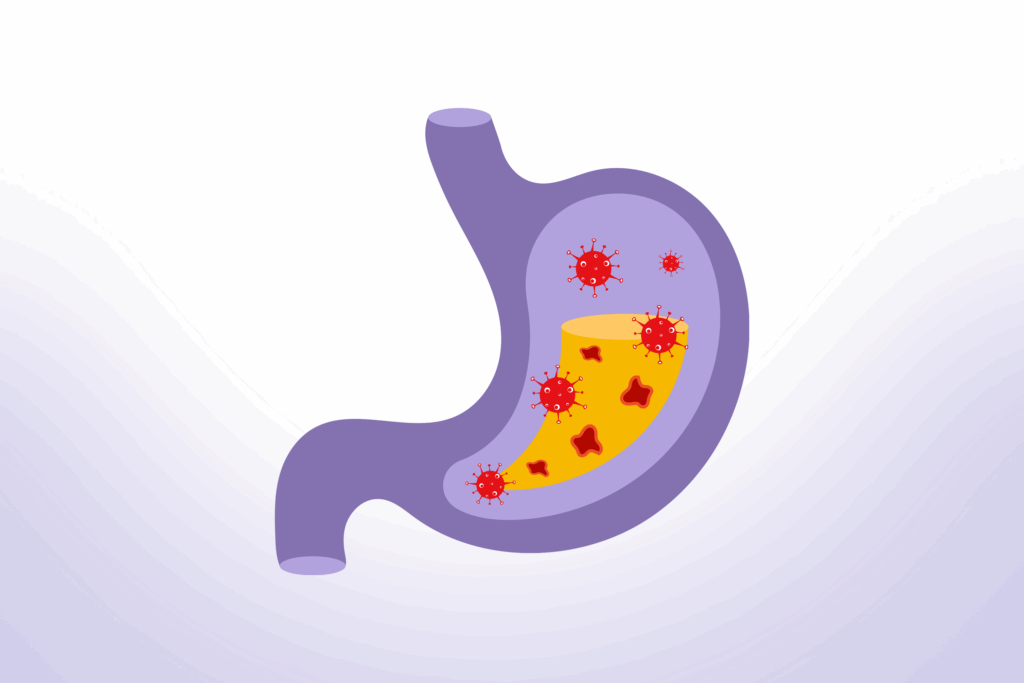 Serupa Tapi Tak Sama, Ini Dia Perbedaan IBS dan IBD 3 Perbedaan dalam Diagnosis