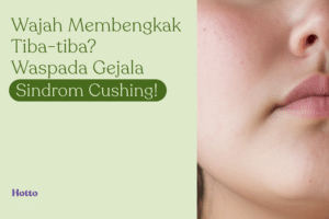 Wajah Membengkak Tiba-tiba Waspada Gejala Sindrom Cushing